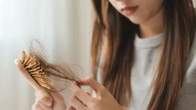 Rambut Rontok Generasi Muda Jadi Isu Baru Kesehatan Global